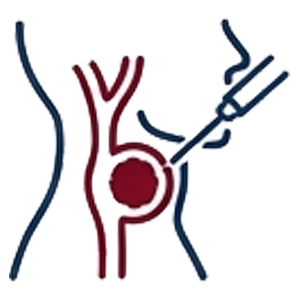 جراحی تومور کاروتید بادی (Carotid Body)